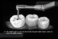 Tandverzorging voor de Jeugd