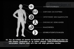 Tandverzorging voor de Jeugd